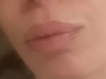 100% natural lips