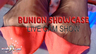 MOVIE: Bunion Showcase Live Cam
