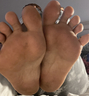 Dirty feet 